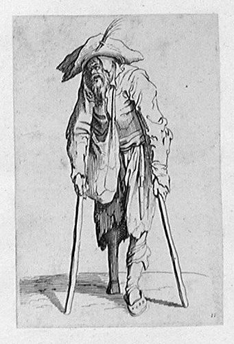 Der Stelzfuß